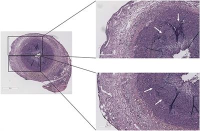 Checks and Balances in Autoimmune Vasculitis